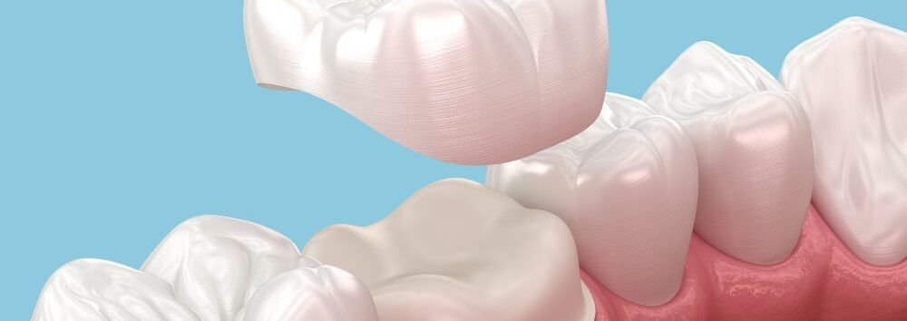 MicrosoftTeams-image-297