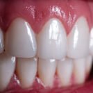 ongoing_support_for_better_dental